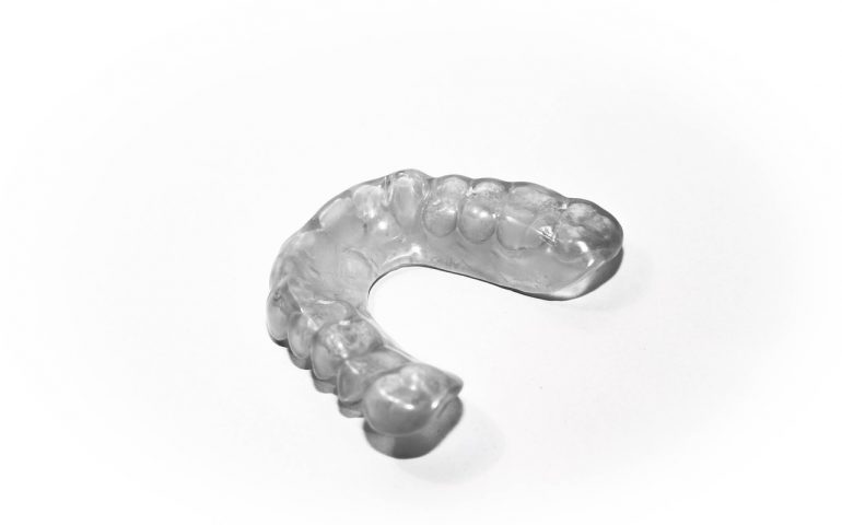 dental-rail-2633035_1280